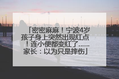 密密麻麻!宁波4岁孩子身上突然出现红点!连小便都变红了……家长:以为只是摔伤